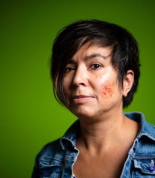 stigWA vrouw met stempel op wang